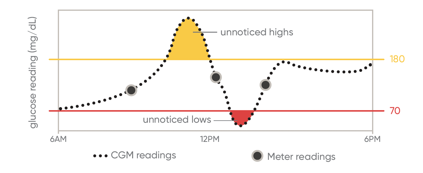 cgm work